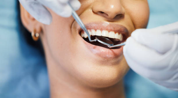 Best Broken Tooth Emergency  in North Auburn, CA